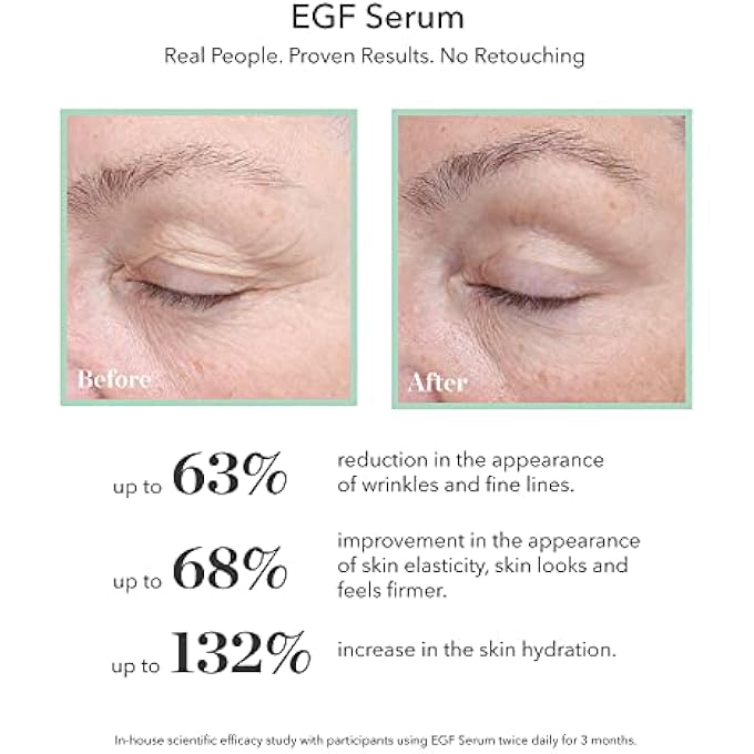 Bioeffect EGF SERUM WITH HYALURONIC ACID AND BARLEY GROWTH FACTOR, BEST REJUVENATING FACIAL TREATMENT FIGHTS WRINKLES, HYDRATING, FIRMING, ANTI-AGING SKINCARE FOR FACE & NECK, OIL-FREE - Image 3